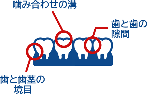 知っておこう!プラークの溜まりやすい場所