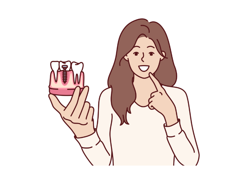 インプラントと骨造成について説明する女性歯科医師のイラスト