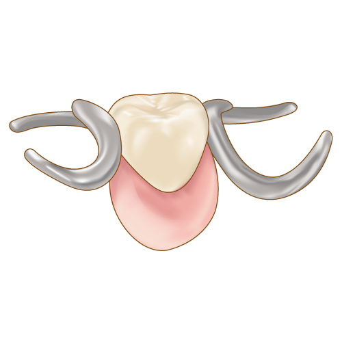 部分入れ歯