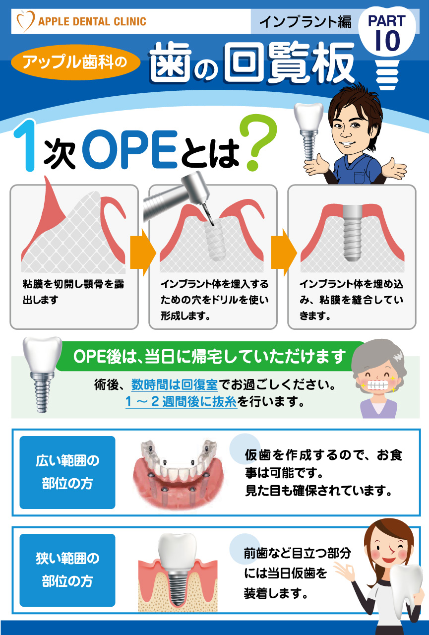 歯の回覧板インプラント編